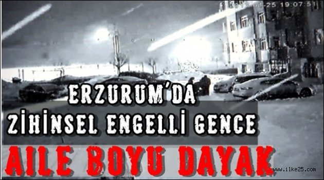 Erzurum'da Zihinsel Engelli Gence Aile Boyu Dayak